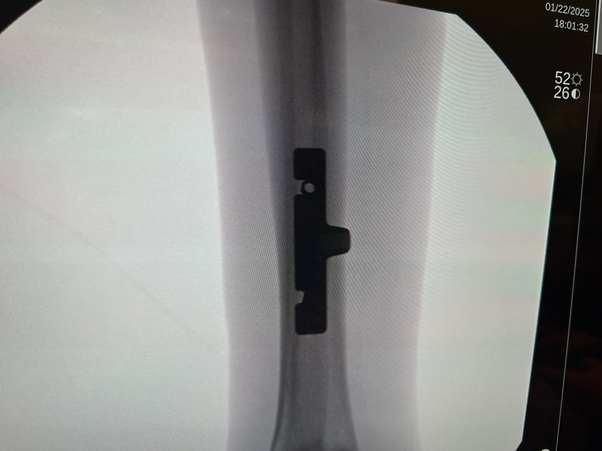 First Case with TrueLok