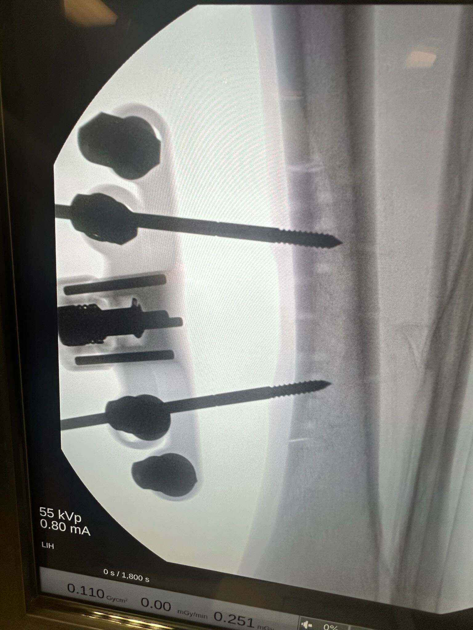 First Case with TrueLok 2